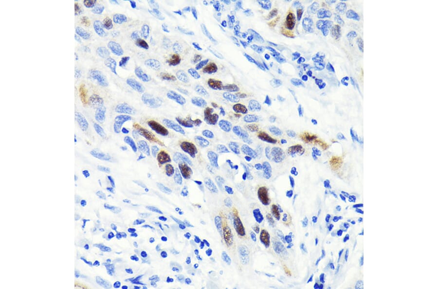 Immunohistochemistry - Anti-Cyclin A2 Antibody [ARC0359] (A308964) - Antibodies.com