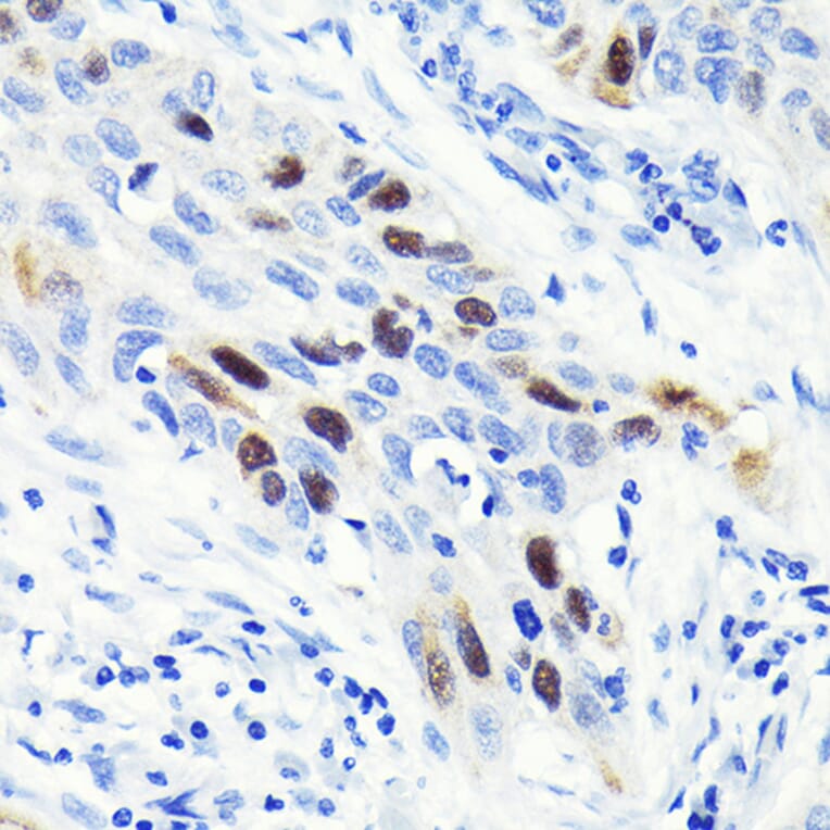 Immunohistochemistry - Anti-Cyclin A2 Antibody [ARC0359] (A308964) - Antibodies.com