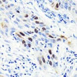 Immunohistochemistry - Anti-Cyclin A2 Antibody [ARC0359] (A308964) - Antibodies.com