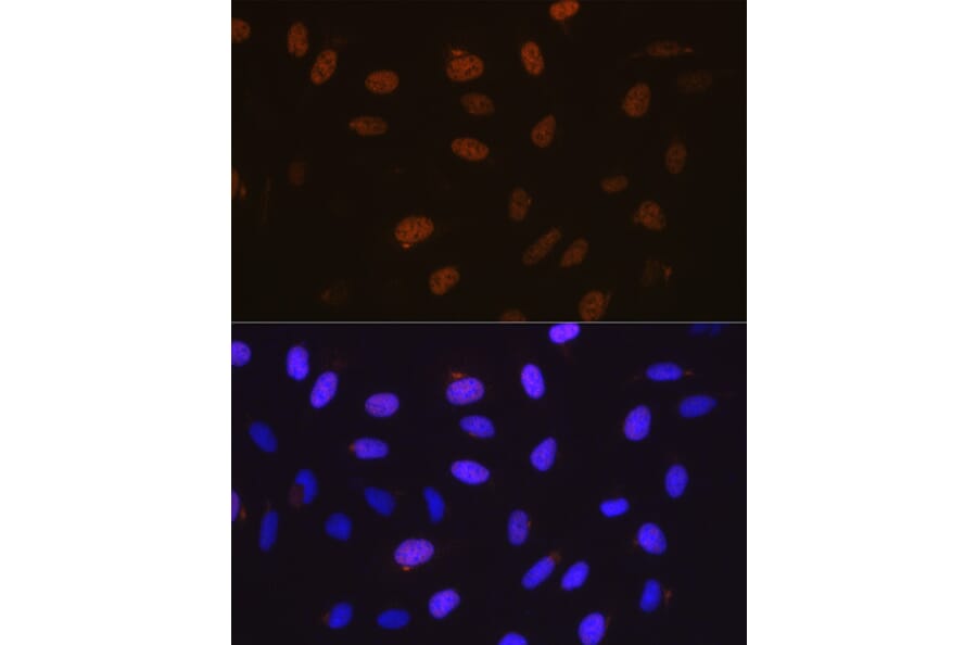 Immunofluorescence - Anti-Cyclin A2 Antibody [ARC0359] (A308964) - Antibodies.com