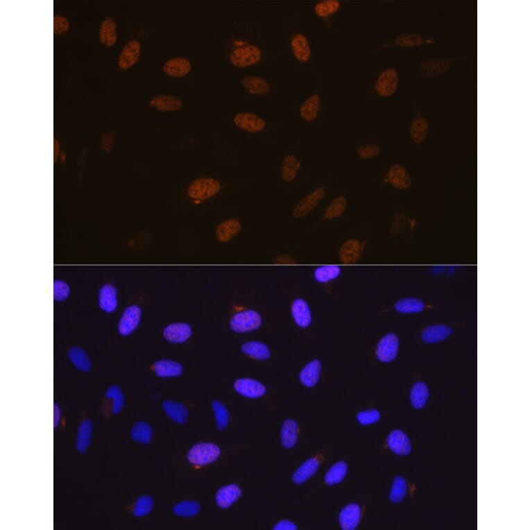 Immunofluorescence - Anti-Cyclin A2 Antibody [ARC0359] (A308964) - Antibodies.com