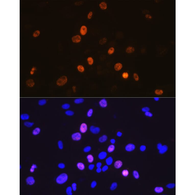 Immunofluorescence - Anti-Cyclin A2 Antibody [ARC0359] (A308964) - Antibodies.com