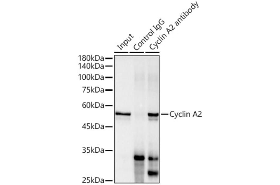 Western Blot - Anti-Cyclin A2 Antibody [ARC0359] (A308964) - Antibodies.com