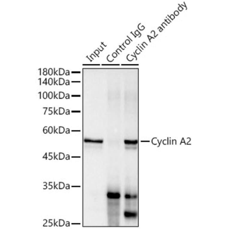 Western Blot - Anti-Cyclin A2 Antibody [ARC0359] (A308964) - Antibodies.com