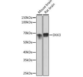 Western Blot - Anti-Dkk3 Antibody [ARC0861] (A308965) - Antibodies.com