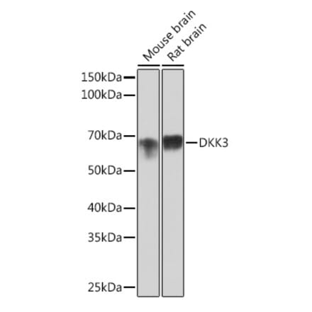 Western Blot - Anti-Dkk3 Antibody [ARC0861] (A308965) - Antibodies.com