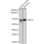 Western Blot - Anti-Dkk3 Antibody [ARC0861] (A308965) - Antibodies.com