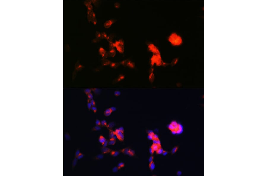 Immunofluorescence - Anti-Dkk3 Antibody [ARC0861] (A308965) - Antibodies.com