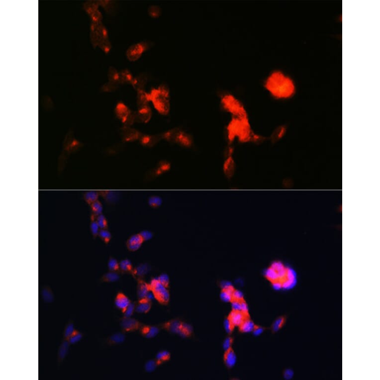Immunofluorescence - Anti-Dkk3 Antibody [ARC0861] (A308965) - Antibodies.com