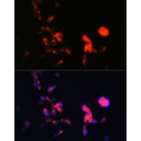 Immunofluorescence - Anti-Dkk3 Antibody [ARC0861] (A308965) - Antibodies.com