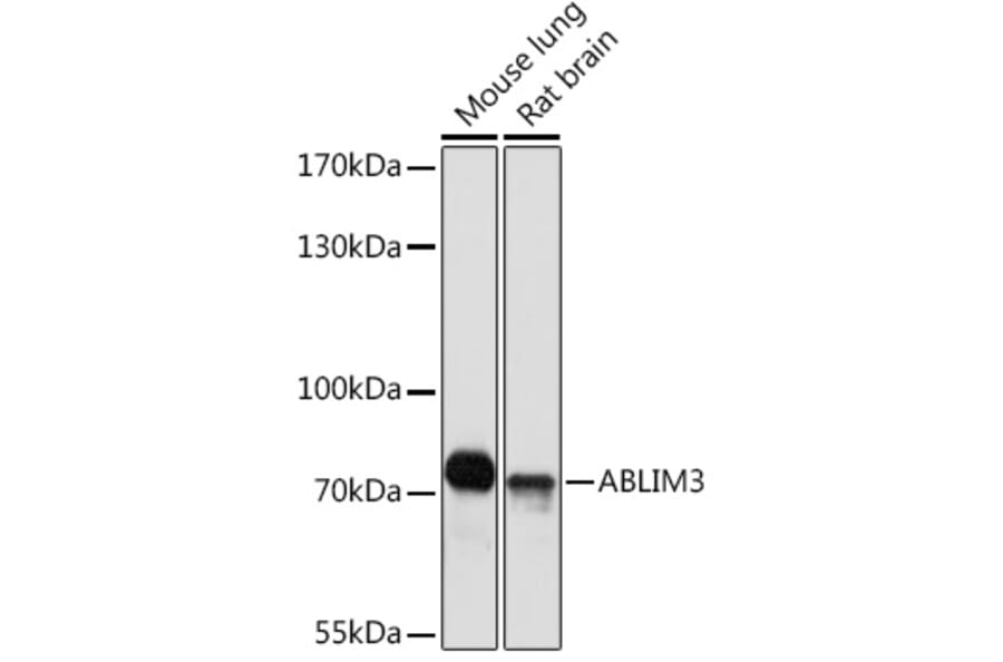 Western Blot - Anti-ABLIM3 Antibody (A308968) - Antibodies.com