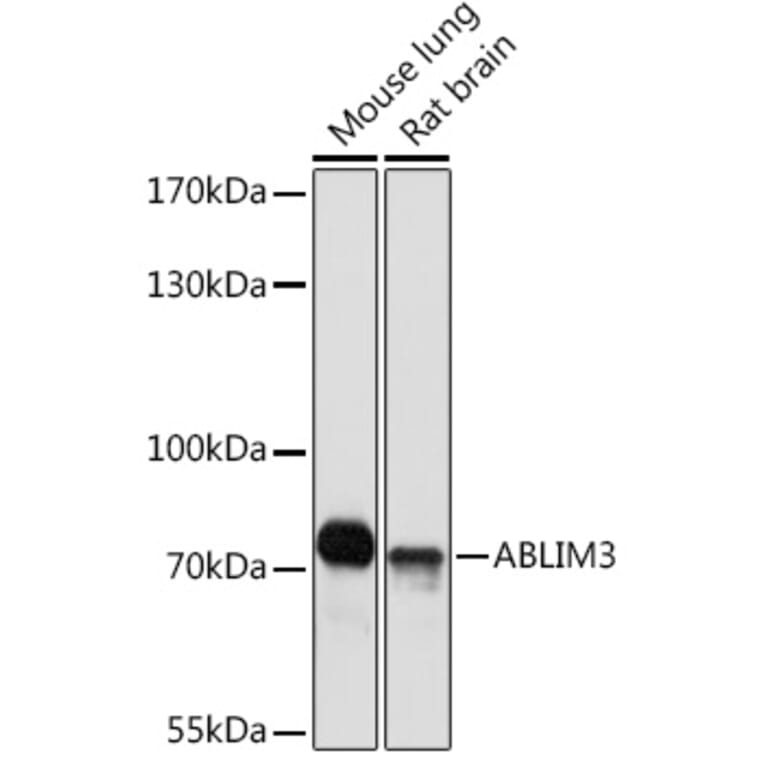 Western Blot - Anti-ABLIM3 Antibody (A308968) - Antibodies.com