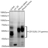 Western Blot - Anti-IL-2RG Antibody [ARC54566] (A308969) - Antibodies.com