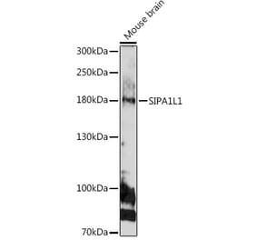Western Blot - Anti-SIPA1L1 Antibody (A308970) - Antibodies.com