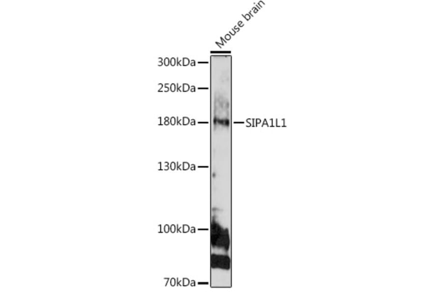 Western Blot - Anti-SIPA1L1 Antibody (A308970) - Antibodies.com