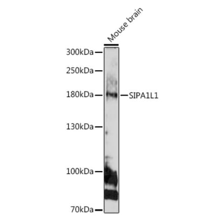 Western Blot - Anti-SIPA1L1 Antibody (A308970) - Antibodies.com