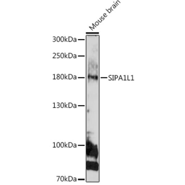 Western Blot - Anti-SIPA1L1 Antibody (A308970) - Antibodies.com