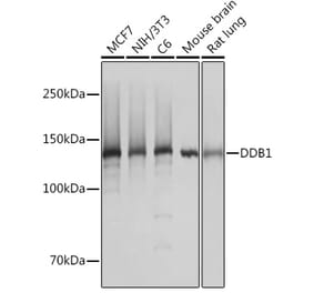 Western Blot - Anti-DDB1 Antibody [ARC1278] (A308971) - Antibodies.com