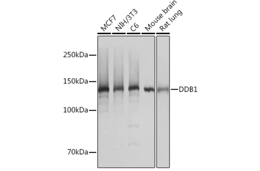 Western Blot - Anti-DDB1 Antibody [ARC1278] (A308971) - Antibodies.com