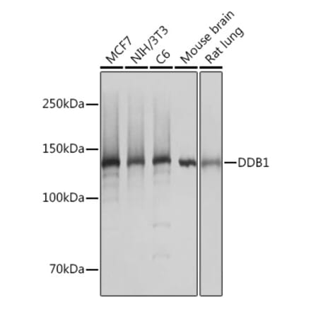 Western Blot - Anti-DDB1 Antibody [ARC1278] (A308971) - Antibodies.com
