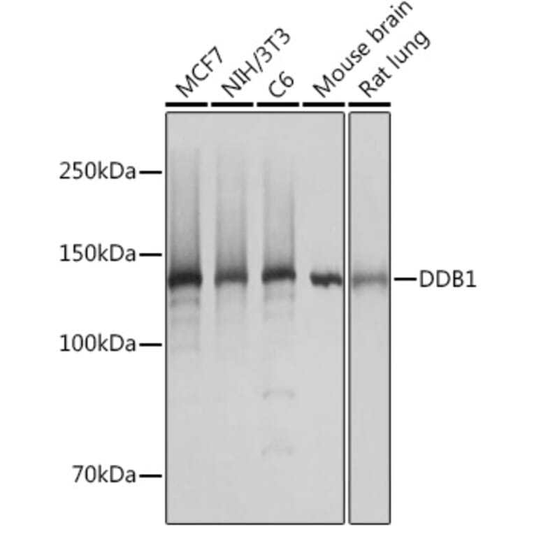Western Blot - Anti-DDB1 Antibody [ARC1278] (A308971) - Antibodies.com