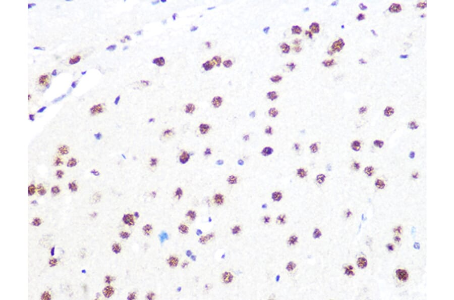 Immunohistochemistry - Anti-DDB1 Antibody [ARC1278] (A308971) - Antibodies.com