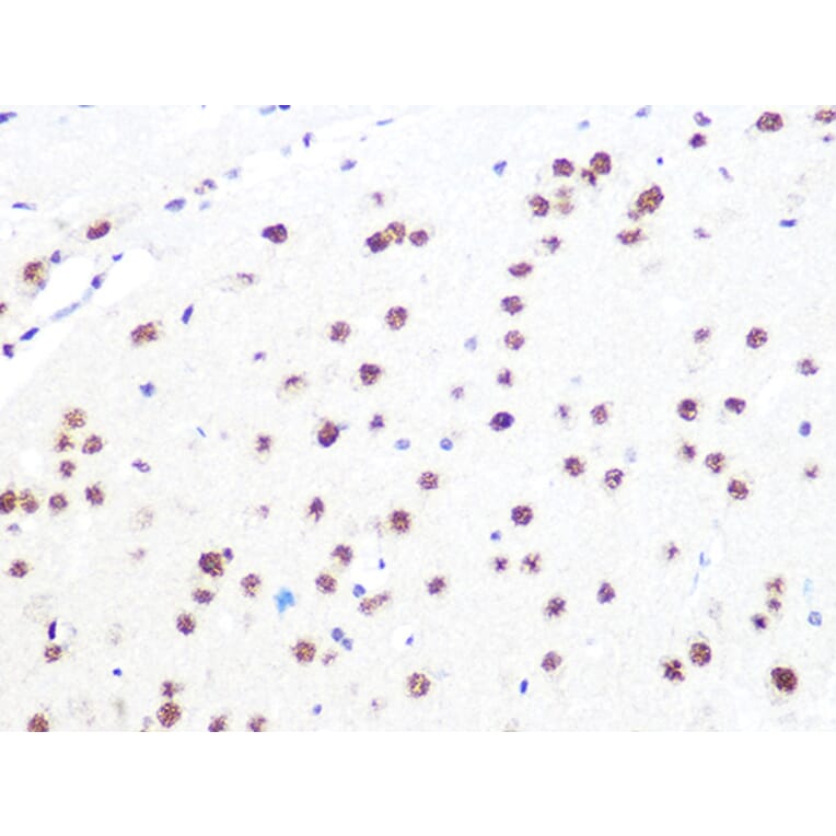 Immunohistochemistry - Anti-DDB1 Antibody [ARC1278] (A308971) - Antibodies.com