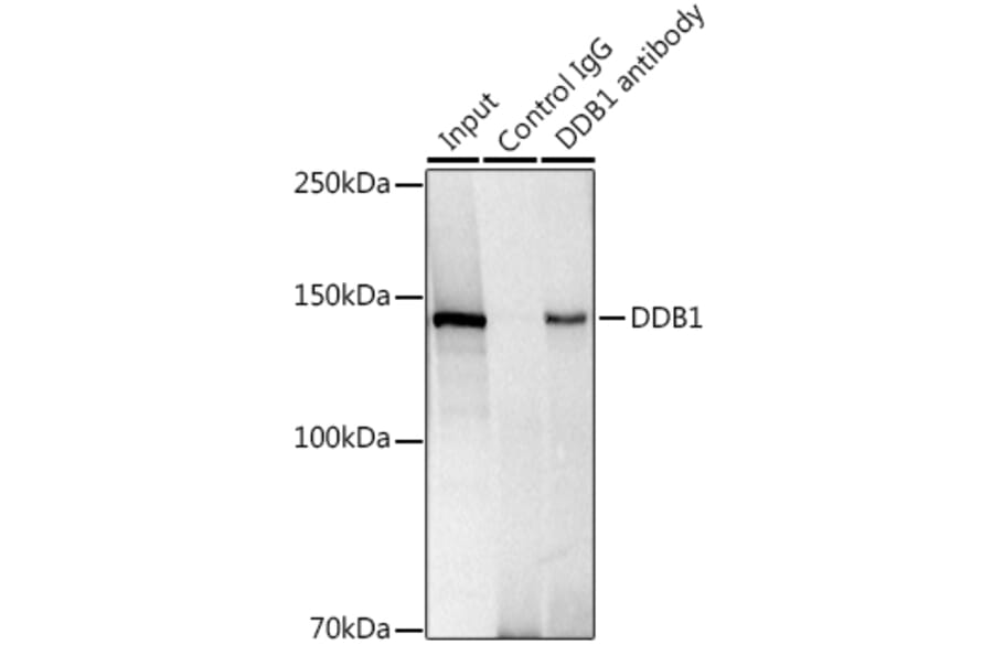Western Blot - Anti-DDB1 Antibody [ARC1278] (A308971) - Antibodies.com