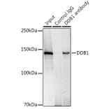 Western Blot - Anti-DDB1 Antibody [ARC1278] (A308971) - Antibodies.com