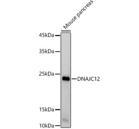 Western Blot - Anti-DNAJC12 Antibody [ARC2898] (A308972) - Antibodies.com