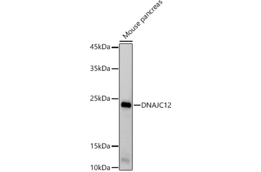 Western Blot - Anti-DNAJC12 Antibody [ARC2898] (A308972) - Antibodies.com