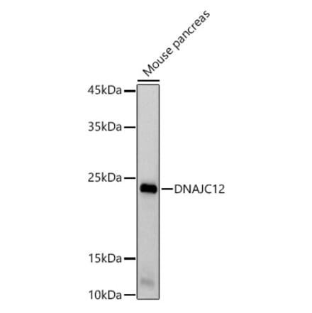Western Blot - Anti-DNAJC12 Antibody [ARC2898] (A308972) - Antibodies.com
