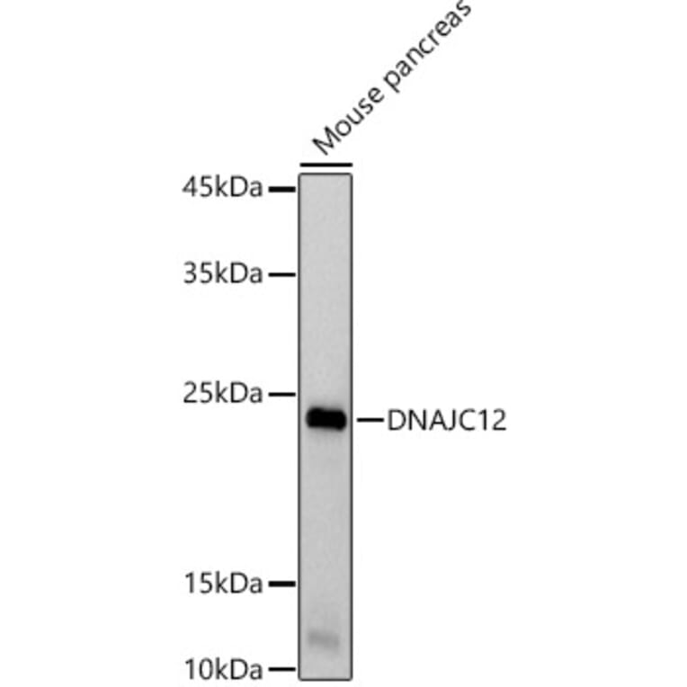 Western Blot - Anti-DNAJC12 Antibody [ARC2898] (A308972) - Antibodies.com