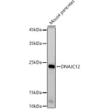 Western Blot - Anti-DNAJC12 Antibody [ARC2898] (A308972) - Antibodies.com