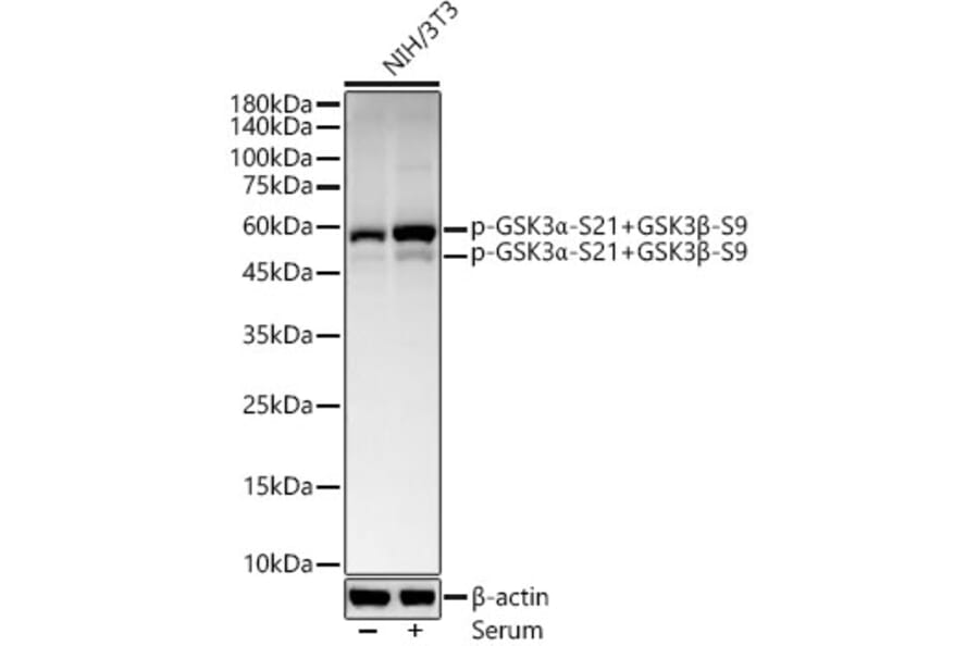 Western Blot - Anti-GSK3 beta (phospho Ser21) Antibody [ARC54771] (A308976) - Antibodies.com