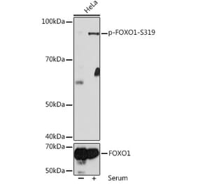 Western Blot - Anti-FOXO1A (phospho Ser319) Antibody (A308977) - Antibodies.com