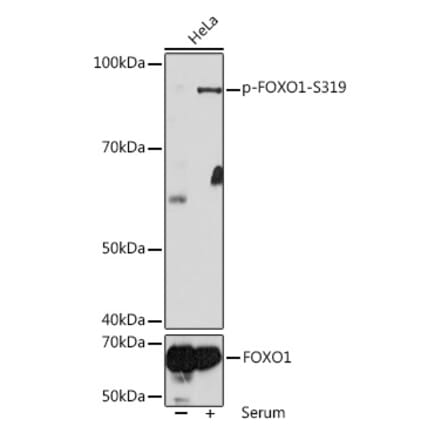 Western Blot - Anti-FOXO1A (phospho Ser319) Antibody (A308977) - Antibodies.com