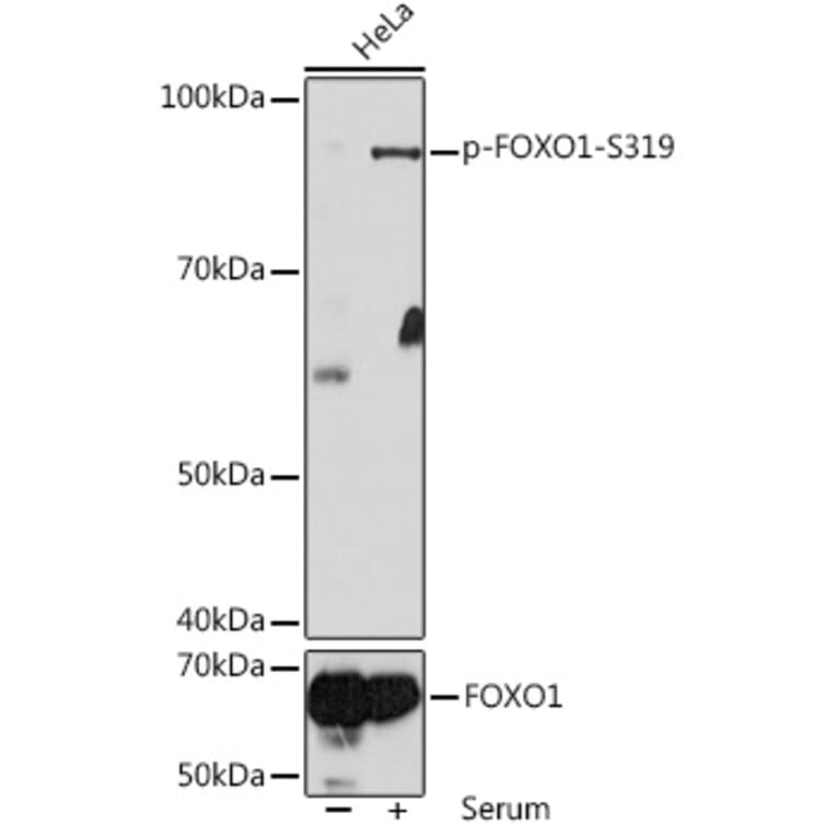 Western Blot - Anti-FOXO1A (phospho Ser319) Antibody (A308977) - Antibodies.com