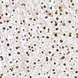 Immunohistochemistry - Anti-FOXO1A (phospho Ser319) Antibody (A308977) - Antibodies.com
