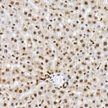 Immunohistochemistry - Anti-FOXO1A (phospho Ser319) Antibody (A308977) - Antibodies.com