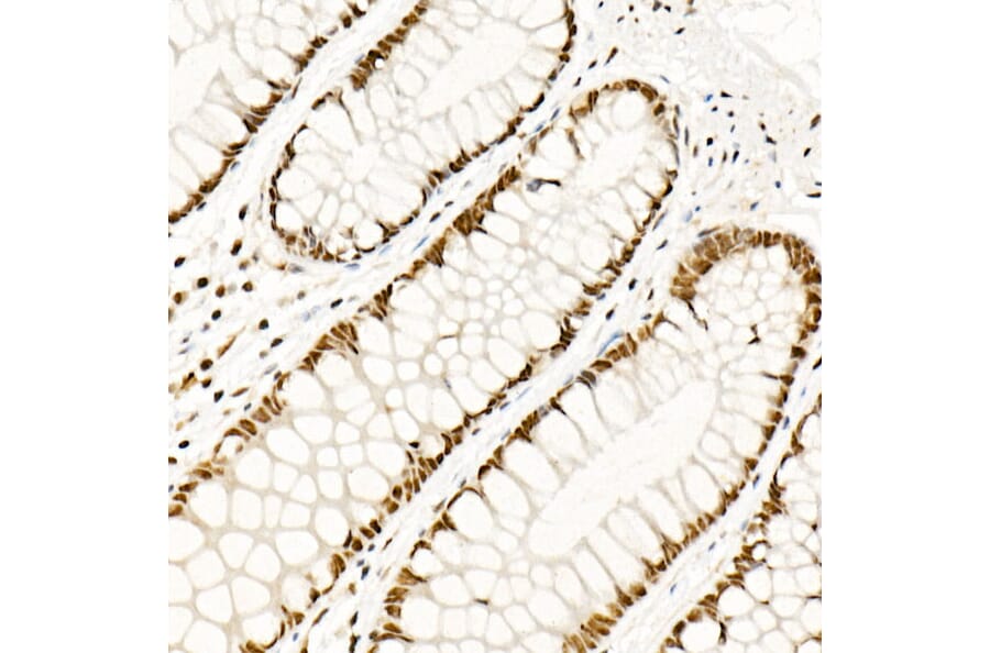 Immunohistochemistry - Anti-HSF1 Antibody (A308978) - Antibodies.com