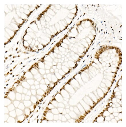 Immunohistochemistry - Anti-HSF1 Antibody (A308978) - Antibodies.com