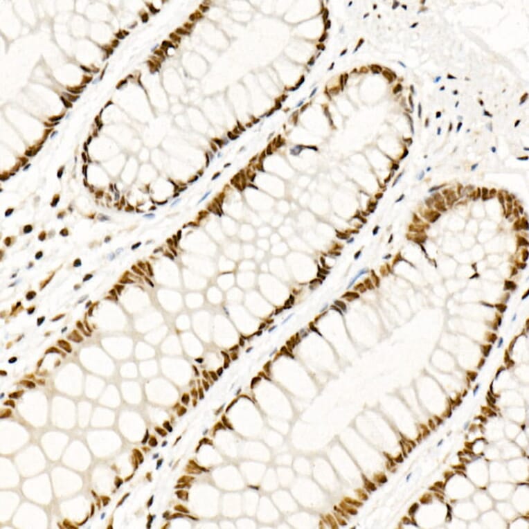 Immunohistochemistry - Anti-HSF1 Antibody (A308978) - Antibodies.com