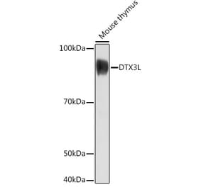 Western Blot - Anti-DTX3L Antibody (A308981) - Antibodies.com