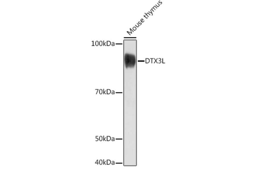 Western Blot - Anti-DTX3L Antibody (A308981) - Antibodies.com