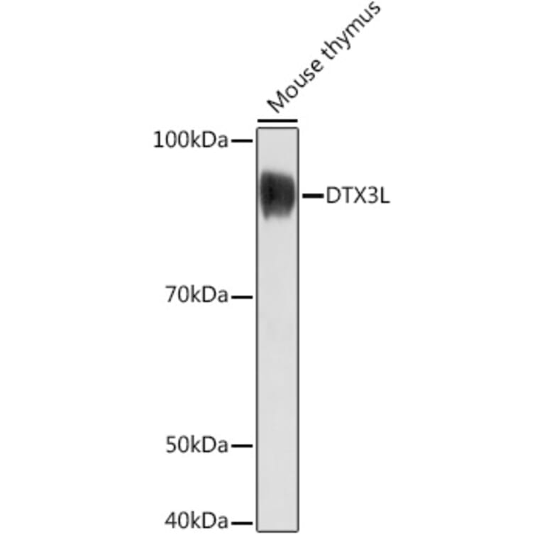 Western Blot - Anti-DTX3L Antibody (A308981) - Antibodies.com
