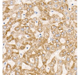 Immunohistochemistry - Anti-ND6 Antibody [ARC52554] (A308982) - Antibodies.com