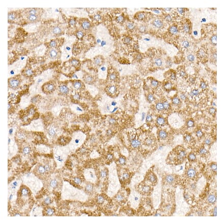 Immunohistochemistry - Anti-ND6 Antibody [ARC52554] (A308982) - Antibodies.com