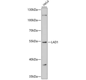 Western Blot - Anti-LAD1 Antibody (A308983) - Antibodies.com