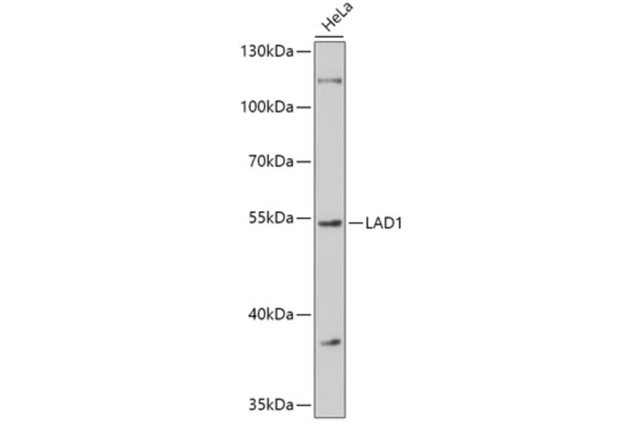 Western Blot - Anti-LAD1 Antibody (A308983) - Antibodies.com
